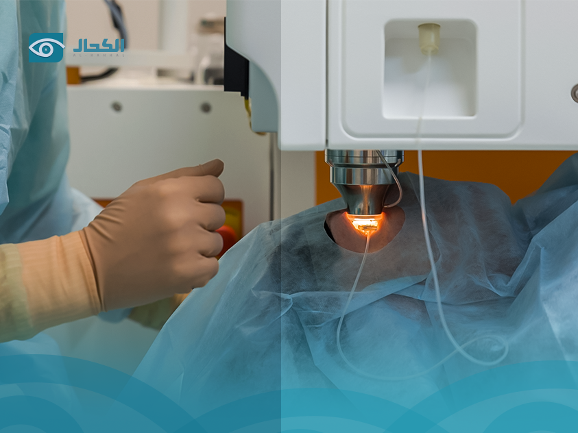عملية الماء الابيض