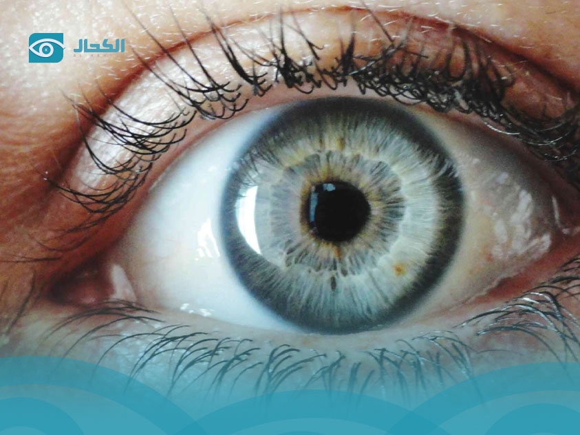 ذبابة-العين