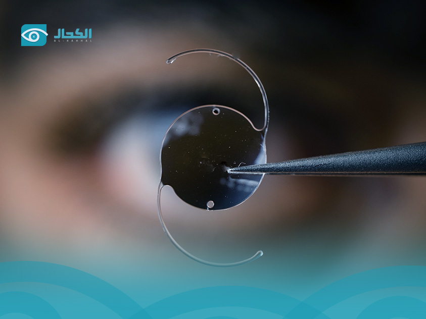 زرع عدسه في العين