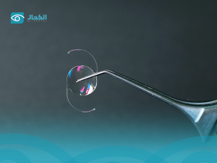 زراعة العدسات