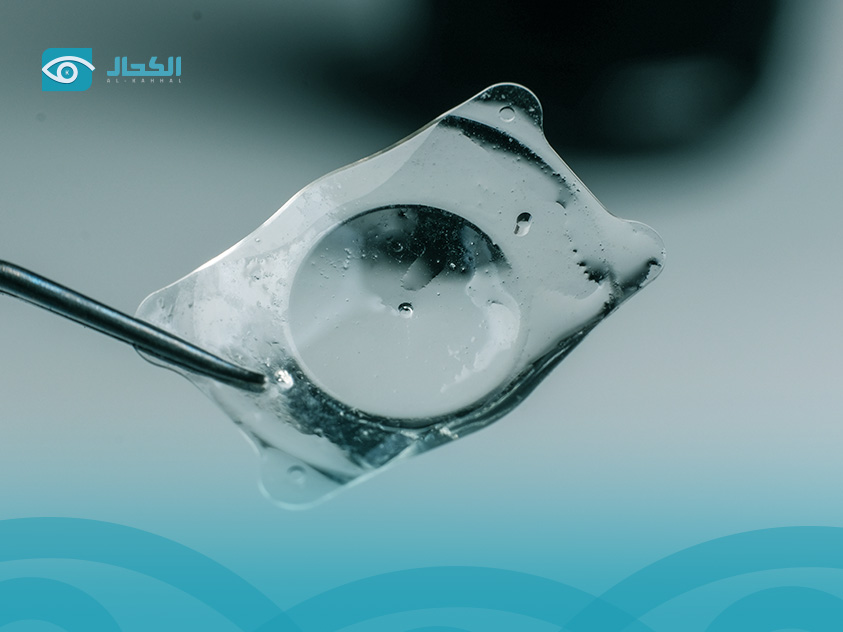 زرع العدسات داخل العين