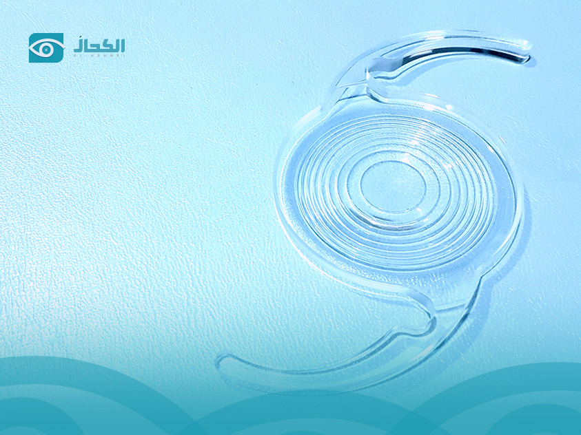 تكلفة زراعة عدسات icl