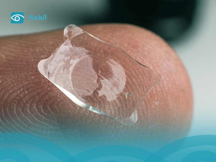 زراعة العدسات icl