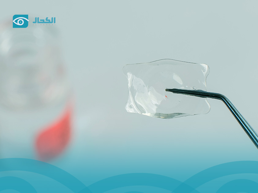 جراحة زراعة العدسات icl