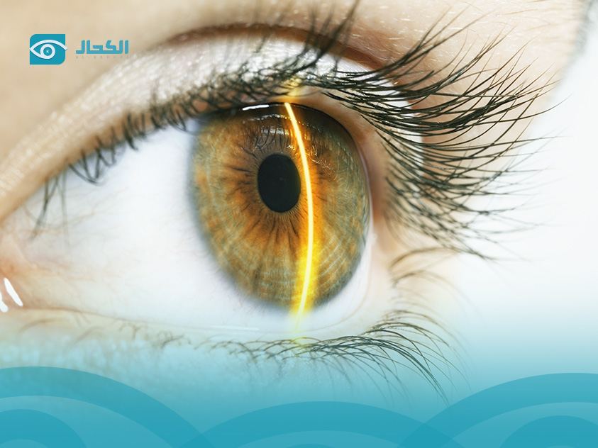 جراحات تصحيح الإبصار بالليزر
