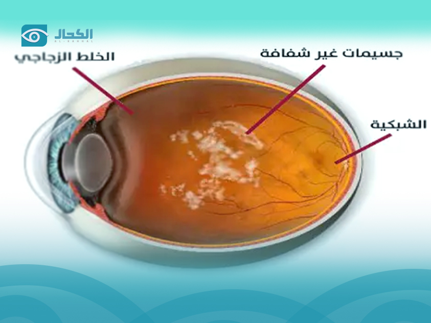 ذبابة-العين ذبابة-العين