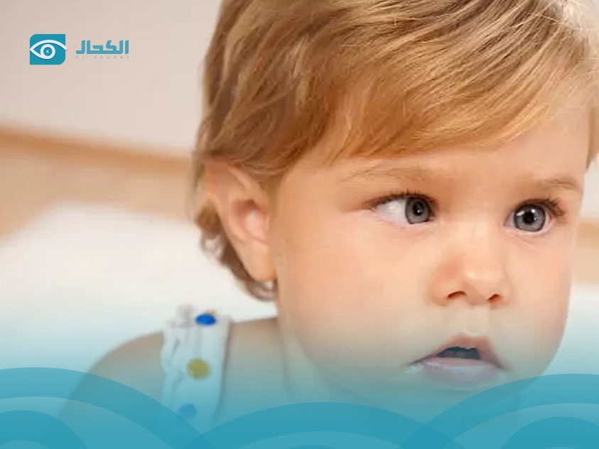 رأرأة-العين