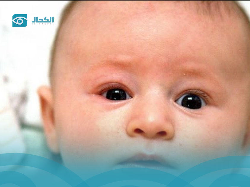 رأرأة-العين