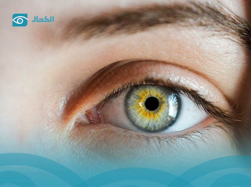 ذبابة-العين ذبابة-العين