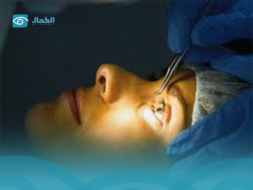 Benefits of Laser Vision Correction Surgery