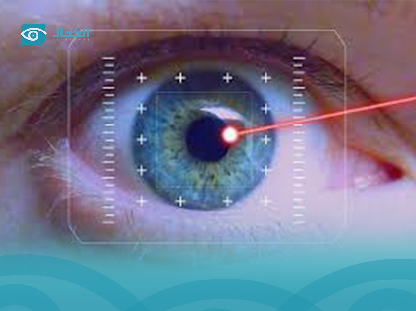 Laser Vision Correction