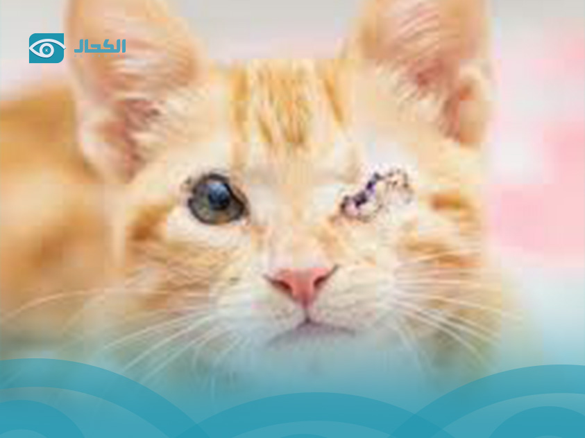 treatment for eye infection