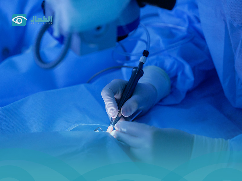 السن-المناسب-لعملية-الليزك