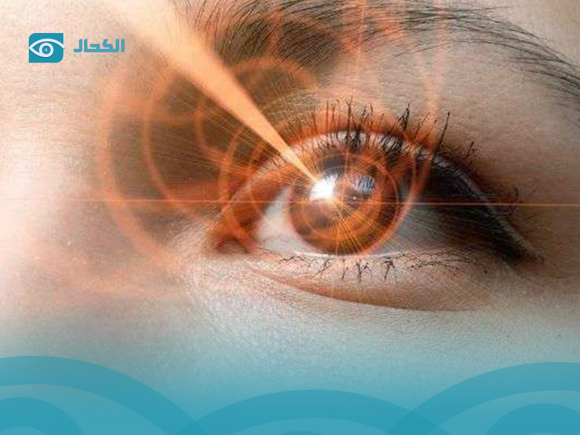 السن-المناسب-لجراحة-العيون-بالليزر