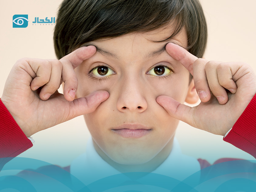 أعراض إفرازات العين