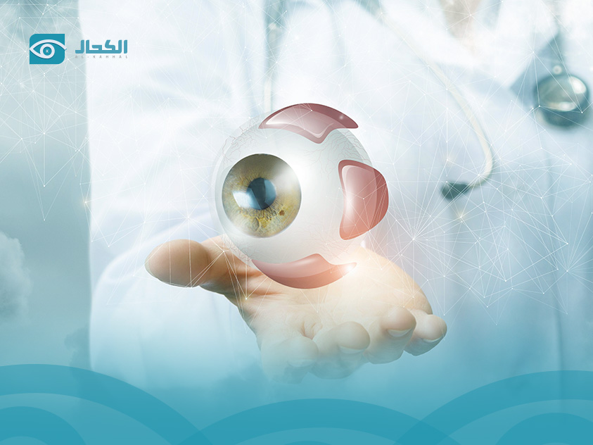 تعليمات ما بعد الليزك