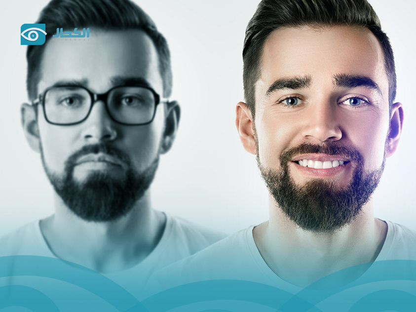 تعليمات ما بعد الليزك