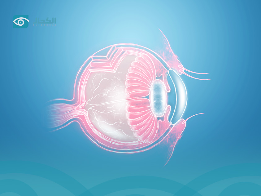 القرنيه المخروطيه