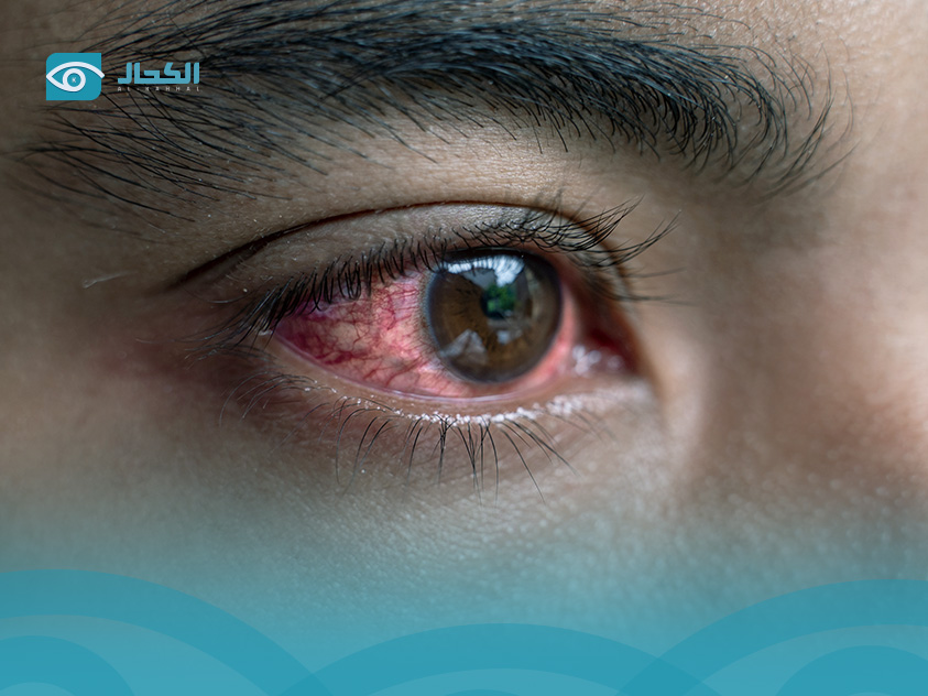 أمراض-العيون-الشائعة