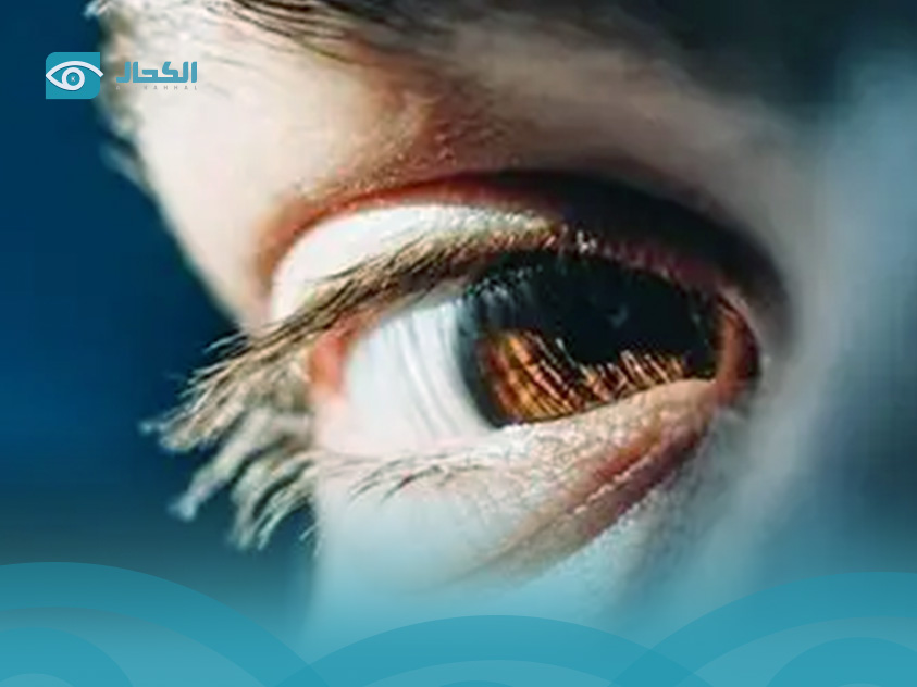 تحسس-العين-من-الضوء تحسس-العين-من-الضوء