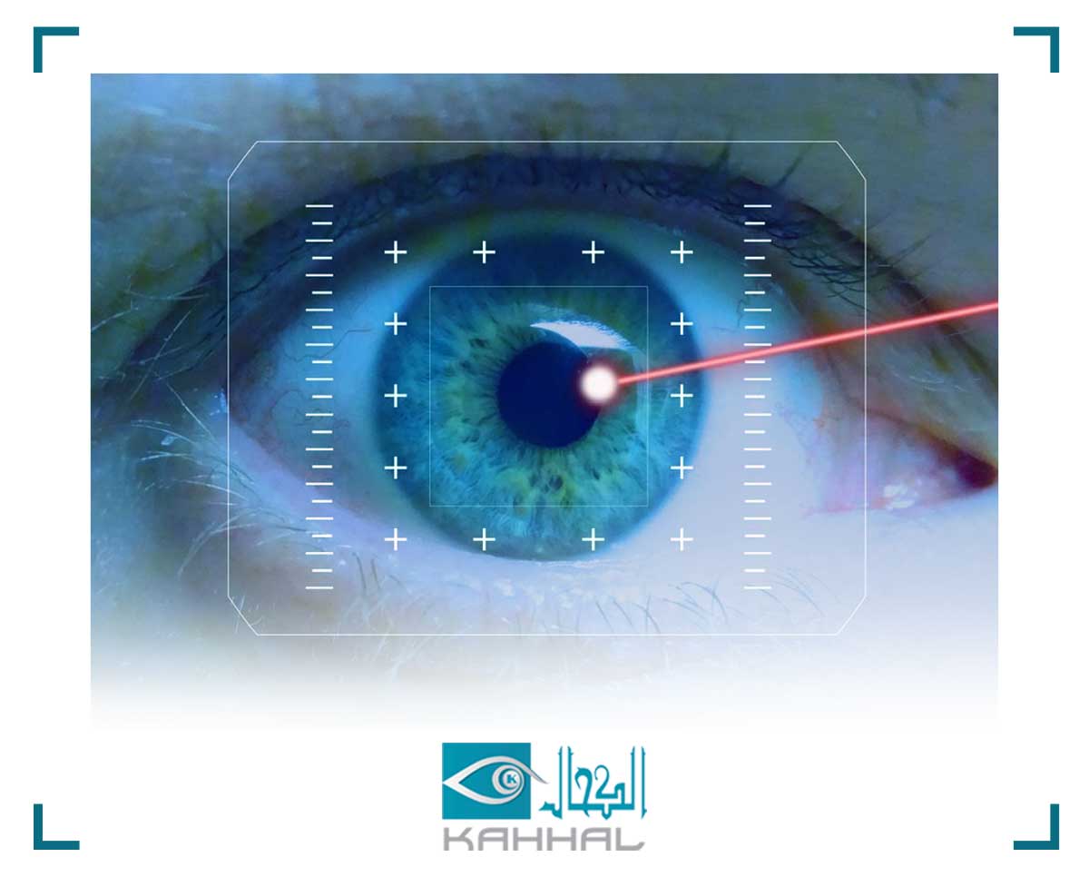 جراحات تصحيح الابصار بالليزر