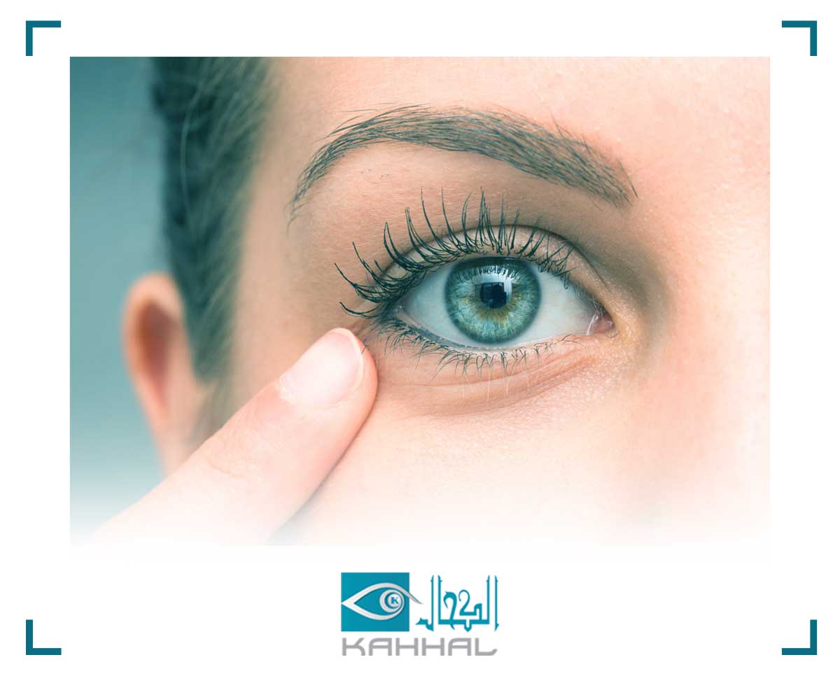 معلومات عن تسريب العين