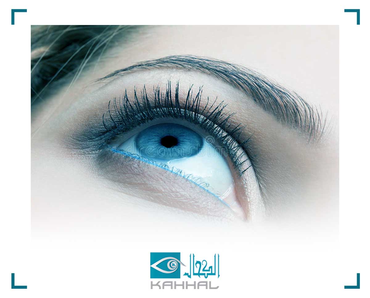 حالة الزجاجي المنفصل