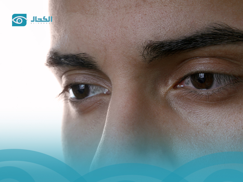 اسباب البقع في العين