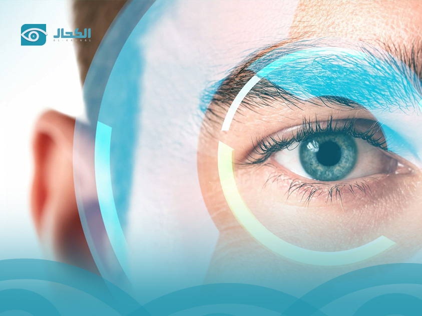 Smile Eye Surgery