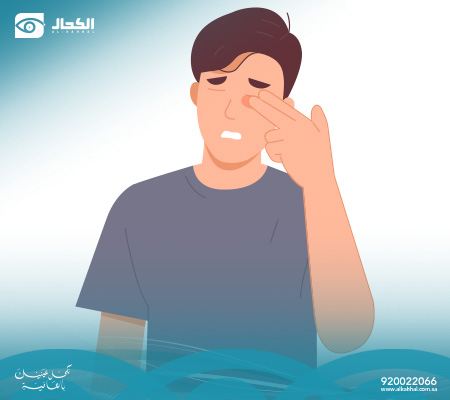 تصحيح النظر بالليزك