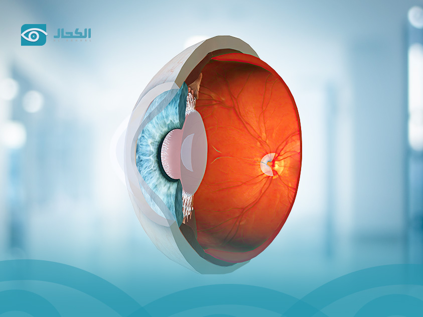 قرحة القرنية